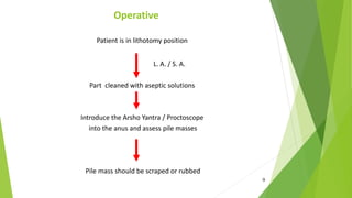 Patient is in lithotomy position
L. A. / S. A.
Part cleaned with aseptic solutions
Introduce the Arsho Yantra / Proctoscop...