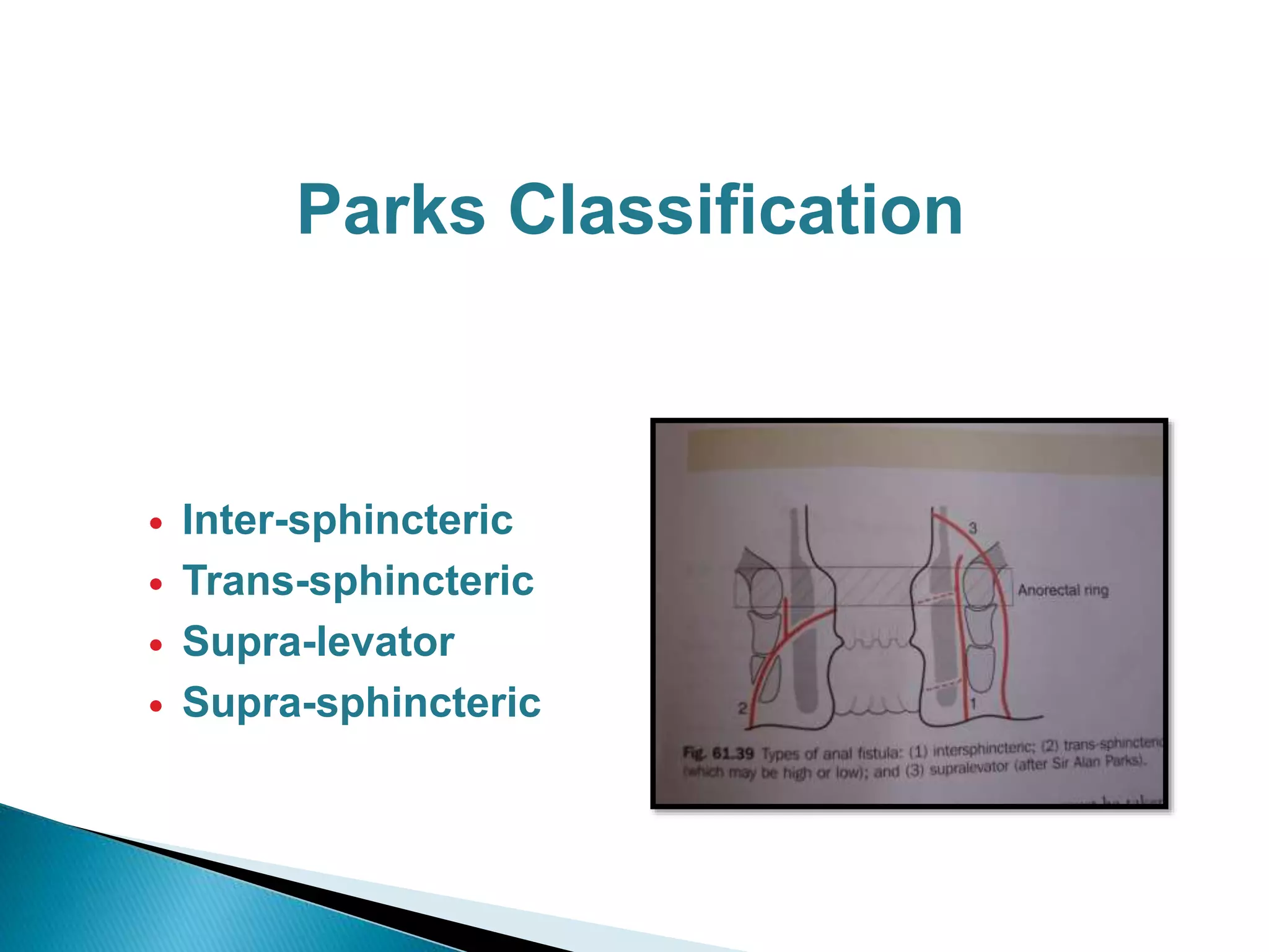 Kshar sutra treatment in Fistula in ano | PPTX