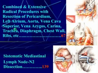 Combined &   E xtensive  R adical  P rocedures with  R esection of  P ericardium,  L eft  A trium,  A orta,  V ena  C ava  S uperior,  V ena  A zygos,  C arina,  Trachea, D iaphragm,  C hest  W all , Ribs, etc…..……………………. 67 Sistematic Mediastinal Lymph Node-N2 Dissection………….. 139 