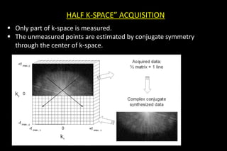 HALF K-SPACE” ACQUISITION
 Only part of k-space is measured.
 The unmeasured points are estimated by conjugate symmetry
through the center of k-space.
 