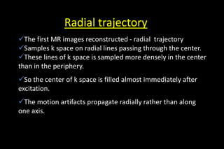 Radial trajectory
The first MR images reconstructed - radial trajectory
Samples k space on radial lines passing through the center.
These lines of k space is sampled more densely in the center
than in the periphery.
So the center of k space is filled almost immediately after
excitation.
The motion artifacts propagate radially rather than along
one axis.
 