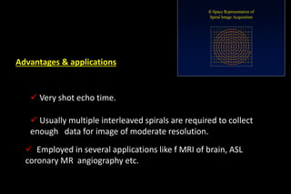  Very shot echo time.
 Employed in several applications like f MRI of brain, ASL
coronary MR angiography etc.
Advantages & applications
 Usually multiple interleaved spirals are required to collect
enough data for image of moderate resolution.
K-Space Representation of
Spiral Image Acquisition
 