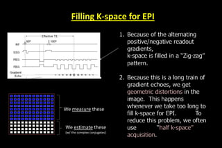 Filling K-space for EPI
1. Because of the alternating
positive/negative readout
gradients,
k-space is filled in a “Zig-zag”
pattern.
2. Because this is a long train of
gradient echoes, we get
geometric distortions in the
image. This happens
whenever we take too long to
fill k-space for EPI. To
reduce this problem, we often
use “half k-space”
acquisition.
We measure these
We estimate these
(w/ the complex conjugates)
 