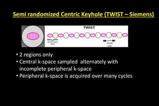 Semi randomized Centric Keyhole (TWIST – Siemens)
• 2 regions only
• Central k-space sampled alternately with
incomplete peripheral k-space
• Peripheral k-space is acquired over many cycles
 