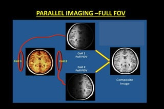 PARALLEL IMAGING –FULL FOV
 Consider image with the field of view (FOV) as shown
and two
coils with the following sensitivities


Full FOV


Half FOV
 