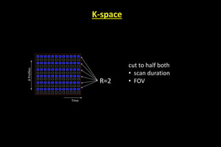 K-space
#Profiles
Time
R=2
cut to half both
• scan duration
• FOV
 