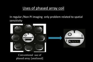 Uses of phased array coil
In regular /Non PI imaging only problem related to spatial
sensitivity
Conventional use of
phased array [unaliased]
 