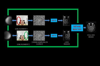 FFT
FFT
SENSE
RECON
FULL FOV
IMAGE
r FOV
IMAGES
COILCALIBRATION
COIL ELEMENT 1
COIL ELEMENT 2
UNDER SAMPLING IN
K-SPACE
SENSE (IMAGE BASED)
 