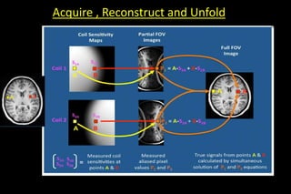 Acquire , Reconstruct and Unfold
 
