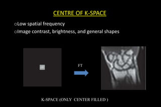 CENTRE OF K-SPACE
oLow spatial frequency
oImage contrast, brightness, and general shapes
K-SPACE (ONLY CENTER FILLED ))
FT
 