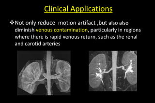 Clinical Applications
Not only reduce motion artifact ,but also also
diminish venous contamination, particularly in regions
where there is rapid venous return, such as the renal
and carotid arteries
 