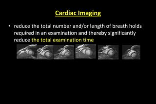 Cardiac Imaging
• reduce the total number and/or length of breath holds
required in an examination and thereby significantly
reduce the total examination time
 