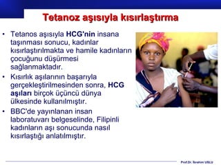 Prof.Dr. İbrahim USLU
• Tetanos aşısıyla HCG'nin insana
taşınması sonucu, kadınlar
kısırlaştırılmakta ve hamile kadınların
çocuğunu düşürmesi
sağlanmaktadır.
• Kısırlık aşılarının başarıyla
gerçekleştirilmesinden sonra, HCG
aşıları birçok üçüncü dünya
ülkesinde kullanılmıştır.
• BBC'de yayınlanan insan
laboratuvarı belgeselinde, Filipinli
kadınların aşı sonucunda nasıl
kısırlaştığı anlatılmıştır.
Tetanoz aşısıyla kısırlaştırmaTetanoz aşısıyla kısırlaştırma
 