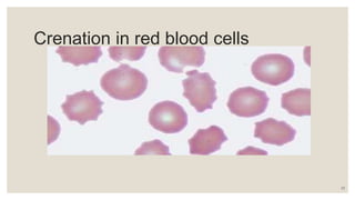 Mild Crenation Rbc KSSM BIO F4 CHAPTER 3 3.3 3.4.pptx