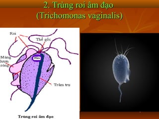 2. Trùng roi âm đạo
(Trichomonas vaginalis)
 