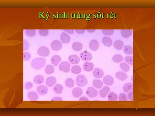 Ký sinh trùng sốt rét
 