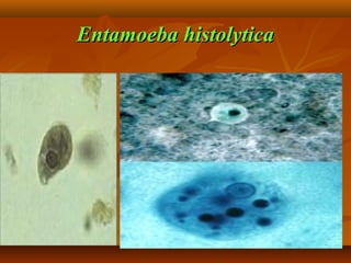 Entamoeba histolytica
 