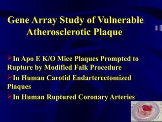 Gene Array Study of Vulnerable
Atherosclerotic Plaque
In Apo E K/O Mice Plaques Prompted to
Rupture by Modified Falk Procedure
In Human Carotid Endarterectomized
Plaques
In Human Ruptured Coronary Arteries
 