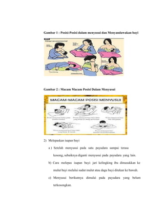 Gambar 1 : Posisi-Posisi dalam menyusui dan Menyandawakan bayi
Gambar 2 : Macam Macam Posisi Dalam Menyusui
2) Melepaskan isapan bayi
a ) Setelah menyusui pada satu payudara sampai terasa
kosong, sebaiknya diganti menyusui pada payudara yang lain.
b) Cara melepas isapan bayi: jari kelingking ibu dimasukkan ke
mulut bayi melalui sudut mulut atau dagu bayi ditekan ke bawah.
c) Menyusui berikutnya dimulai pada payudara yang belum
terkosongkan.
 