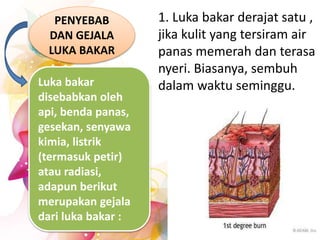 PENYEBAB
DAN GEJALA
LUKA BAKAR
Luka bakar
disebabkan oleh
api, benda panas,
gesekan, senyawa
kimia, listrik
(termasuk petir)
atau radiasi,
adapun berikut
merupakan gejala
dari luka bakar :
1. Luka bakar derajat satu ,
jika kulit yang tersiram air
panas memerah dan terasa
nyeri. Biasanya, sembuh
dalam waktu seminggu.
 
