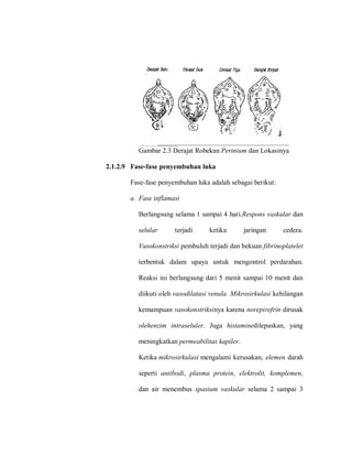 Gambar 2.3 Derajat Robekan Perinium dan Lokasinya
2.1.2.9 Fase-fase penyembuhan luka
Fase-fase penyembuhan luka adalah sebagai berikut:
a. Fase inflamasi
Berlangsung selama 1 sampai 4 hari.Respons vaskular dan
selular terjadi ketika jaringan cedera.
Vasokonstriksi pembuluh terjadi dan bekuan fibrinoplatelet
terbentuk dalam upaya untuk mengontrol perdarahan.
Reaksi ini berlangsung dari 5 menit sampai 10 menit dan
diikuti oleh vasodilatasi venula. Mikrosirkulasi kehilangan
kemampuan vasokonstriksinya karena norepirefrin dirusak
olehenzim intraseluler. Juga histaminedilepaskan, yang
meningkatkan permeabilitas kapiler.
Ketika mikrosirkulasi mengalami kerusakan, elemen darah
seperti antibodi, plasma protein, elektrolit, komplemen,
dan air menembus spasium vaskular selama 2 sampai 3
 