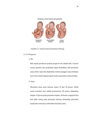 39
Gambar 2.1 macam-macam presentasi bokong
2.1.2.6 Prognosis
a. Ibu
Bila terjadi persalinan spontan prognosis ibu adalah baik. Laserasi
tractus genitalis dan perdarahan dapat disebabkan oleh persalinan
yang terlalu cepat dan dipaksakan melalui panggul yang terlampau
kecil atau melalui bagian-bagian lunak yang belum cukup terbuka.
b. Janin
Mortalitas kasar janin berkisar antara 10 dan 20 persen. Sebeb
utama kematian bayi adalah prematuritas (30 persen disbanding
dengan 10 persen pada presentasi kepala). Kelainan congenital dua
kali lebih sering pada presentasi bokong disbanding presentasi
kepala dan memunyai andil dalam kematian janin.
 