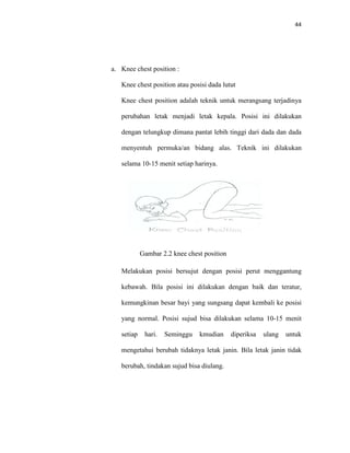 a. Knee chest position :
Knee chest position atau posisi dada lutut
Knee c
perubahan letak menjadi letak kepala. Posisi ini dilakukan
dengan telungkup dimana pantat lebih tinggi dari dada dan dada
menyentuh permuka
selama 10
Melakukan posisi bersujut dengan posisi perut menggantung
kebawah. Bila posisi ini dilakukan dengan baik dan teratur,
kemungkinan besar bayi yang sungsang dapat kembali ke posis
yang normal. Posisi sujud bisa
setiap hari. Sem
mengetahui berubah tidaknya letak janin. Bila letak janin t
berubah, tindakan sujud bi
Knee chest position :
Knee chest position atau posisi dada lutut
Knee chest position adalah teknik untuk merangsang
perubahan letak menjadi letak kepala. Posisi ini dilakukan
dengan telungkup dimana pantat lebih tinggi dari dada dan dada
menyentuh permuka/an bidang alas. Teknik ini dilakukan
selama 10-15 menit setiap harinya.
Gambar 2.2 knee chest position
Melakukan posisi bersujut dengan posisi perut menggantung
kebawah. Bila posisi ini dilakukan dengan baik dan teratur,
kemungkinan besar bayi yang sungsang dapat kembali ke posis
yang normal. Posisi sujud bisa dilakukan selama 10
setiap hari. Seminggu kmudian diperiksa ulang untuk
mengetahui berubah tidaknya letak janin. Bila letak janin t
berubah, tindakan sujud bisa diulang.
44
merangsang terjadinya
perubahan letak menjadi letak kepala. Posisi ini dilakukan
dengan telungkup dimana pantat lebih tinggi dari dada dan dada
an bidang alas. Teknik ini dilakukan
Melakukan posisi bersujut dengan posisi perut menggantung
kebawah. Bila posisi ini dilakukan dengan baik dan teratur,
kemungkinan besar bayi yang sungsang dapat kembali ke posisi
dilakukan selama 10-15 menit
inggu kmudian diperiksa ulang untuk
mengetahui berubah tidaknya letak janin. Bila letak janin tidak
 
