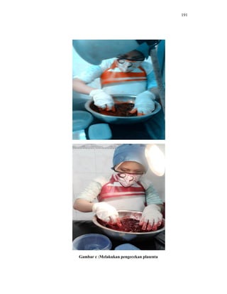 191
Gambar c :Melakukan pengecekan plasenta
 