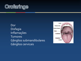 Orofaringe
Dor
Disfagia
Inflamações
Tumores
Gânglios submandibulares
Gânglios cervicais
 