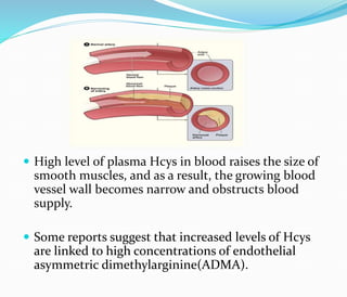 High level of plasma Hcys in blood raises the size of
smooth muscles, and as a result, the growing blood
vessel wall becomes narrow and obstructs blood
supply.
 Some reports suggest that increased levels of Hcys
are linked to high concentrations of endothelial
asymmetric dimethylarginine(ADMA).
 