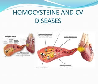 HOMOCYSTEINE AND CV
DISEASES
 