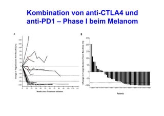Kombination von anti-CTLA4 und
anti-PD1 – Phase I beim Melanom
 