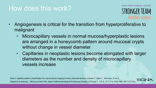 Kudos To You: Learning your Kudo Pit Patterns and Paris Polyp ...
