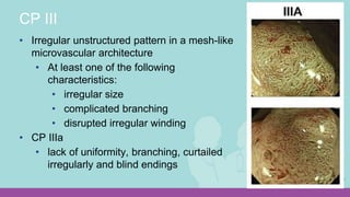 Kudos To You: Learning your Kudo Pit Patterns and Paris Polyp ...