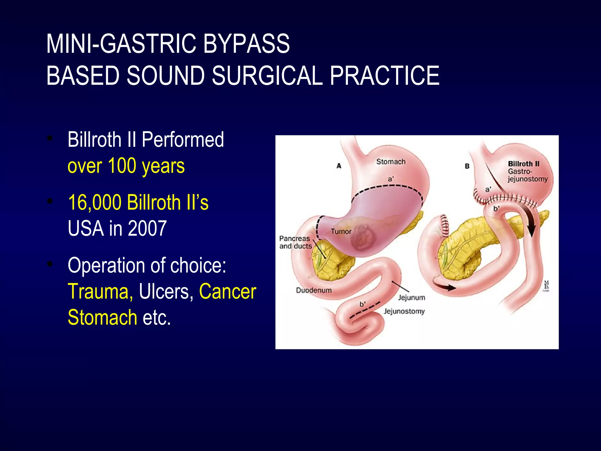 MINI-GASTRIC BYPASS
BASED SOUND SURGICAL PRACTICE
• Billroth II Performed
over 100 years
• 16,000 Billroth II’s
USA in 2007
• Operation of choice:
Trauma, Ulcers, Cancer
Stomach etc.
 