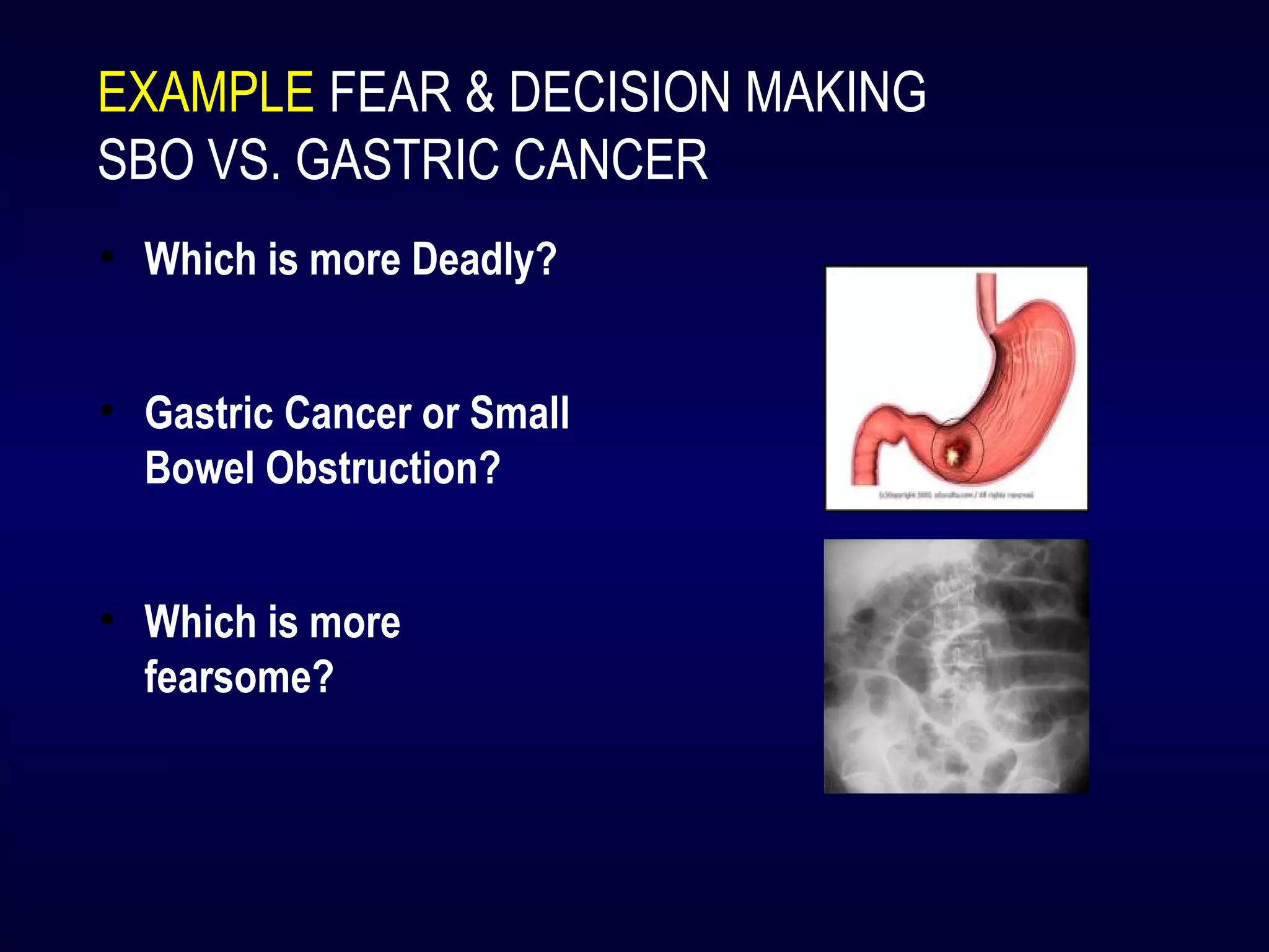 EXAMPLE FEAR & DECISION MAKING
SBO VS. GASTRIC CANCER
• Which is more Deadly?
• Gastric Cancer or Small
Bowel Obstruction?
• Which is more
fearsome?
 