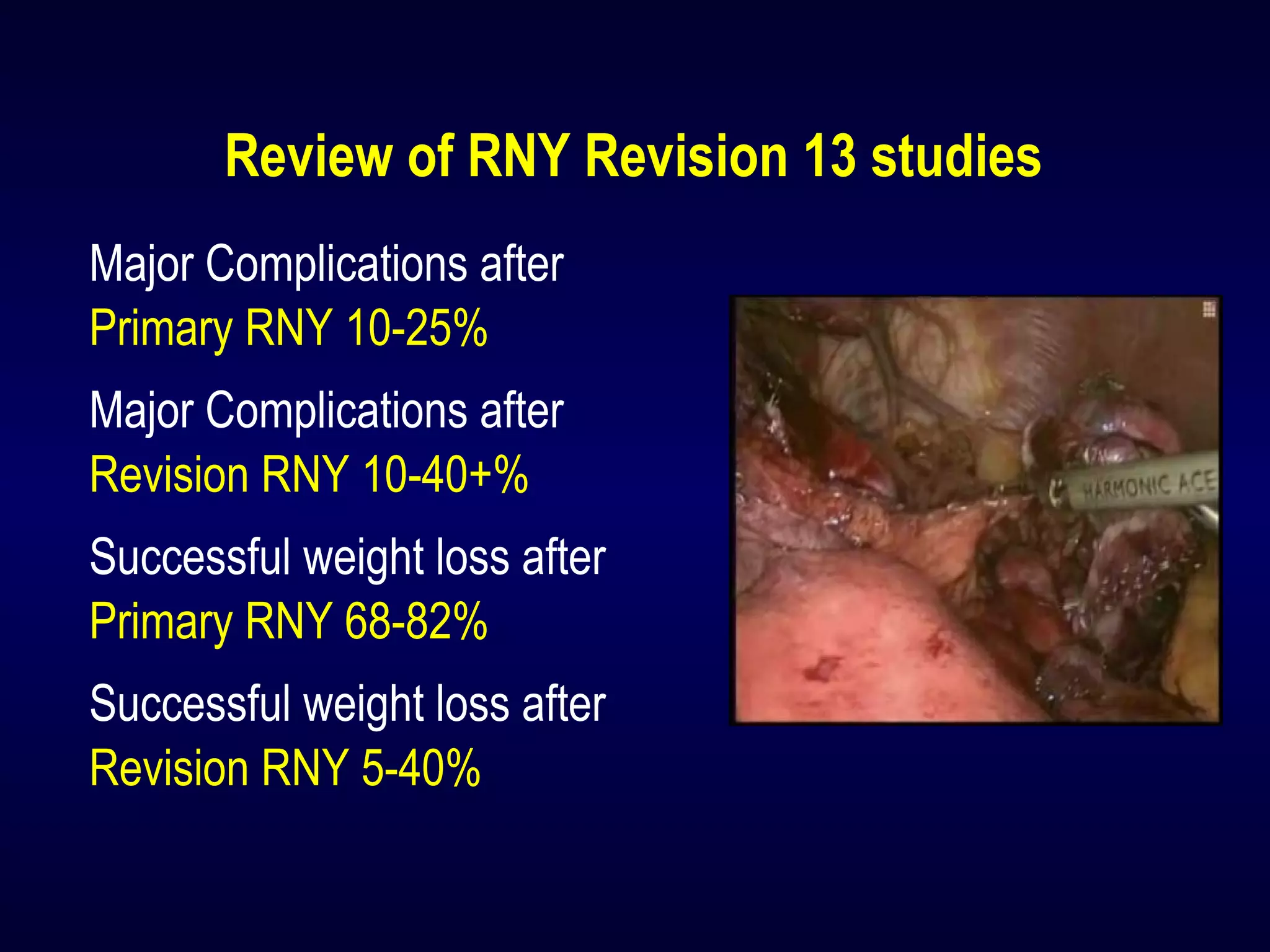 Review of RNY Revision 13 studies
Major Complications after
Primary RNY 10-25%
Major Complications after
Revision RNY 10-40+%
Successful weight loss after
Primary RNY 68-82%
Successful weight loss after
Revision RNY 5-40%
 