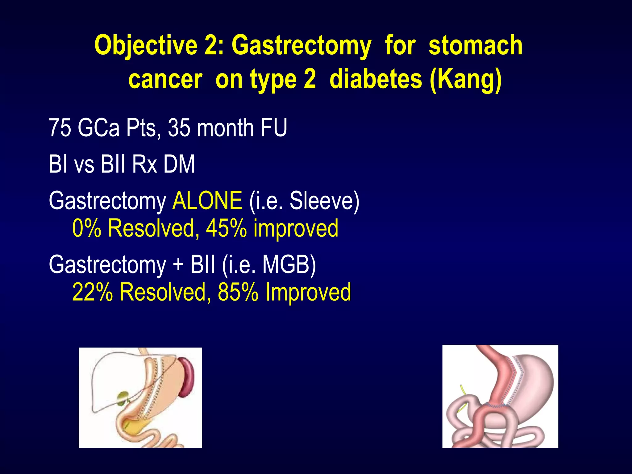 Objective 2: Gastrectomy for stomach 
cancer on type 2 diabetes (Kang)
75 GCa Pts, 35 month FU
BI vs BII Rx DM
Gastrectomy ALONE (i.e. Sleeve)
0% Resolved, 45% improved
Gastrectomy + BII (i.e. MGB)
22% Resolved, 85% Improved
 