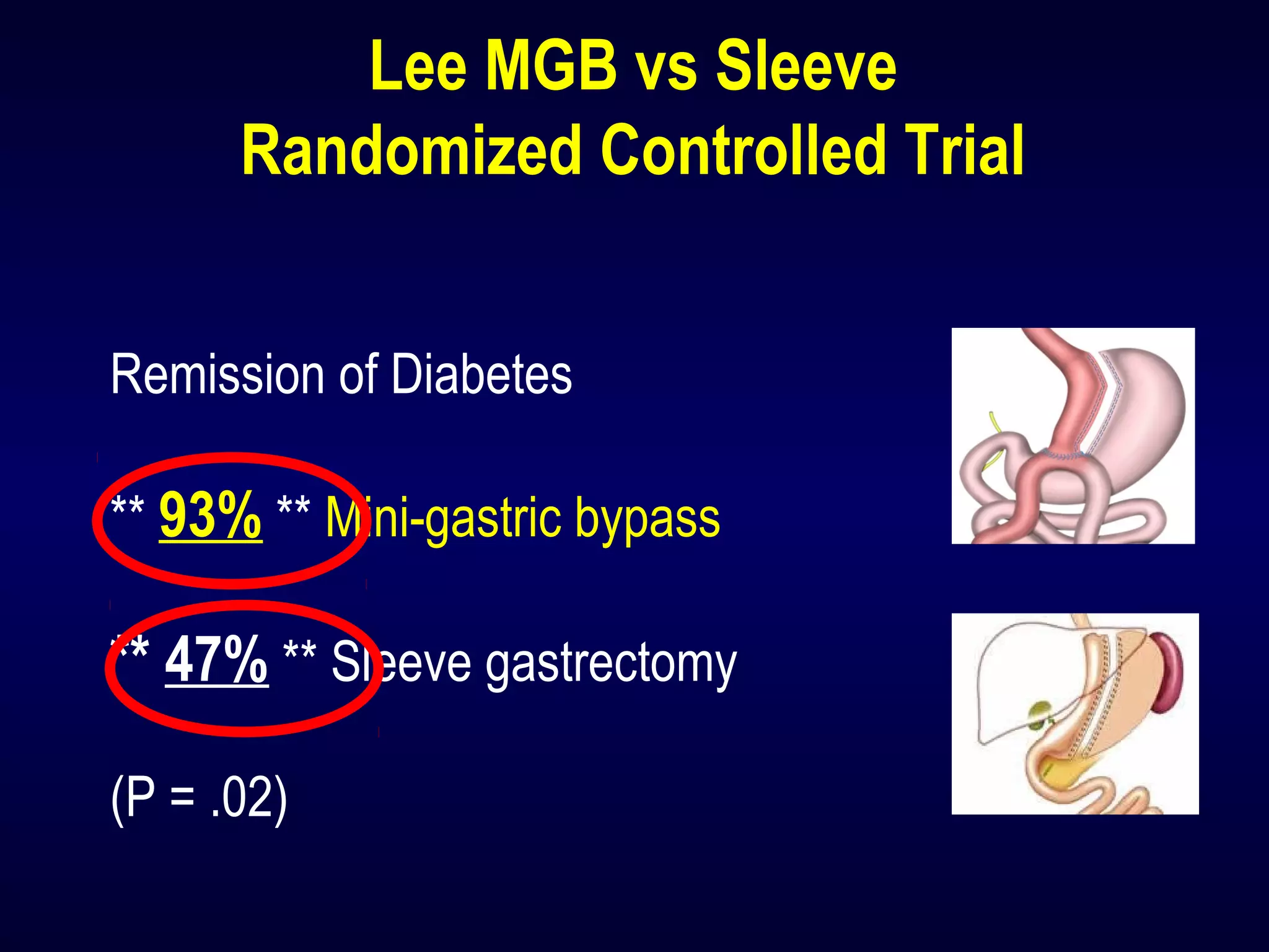 Lee MGB vs Sleeve
Randomized Controlled Trial
Remission of Diabetes
** 93% ** Mini-gastric bypass
** 47% ** Sleeve gastrectomy
(P = .02)
 