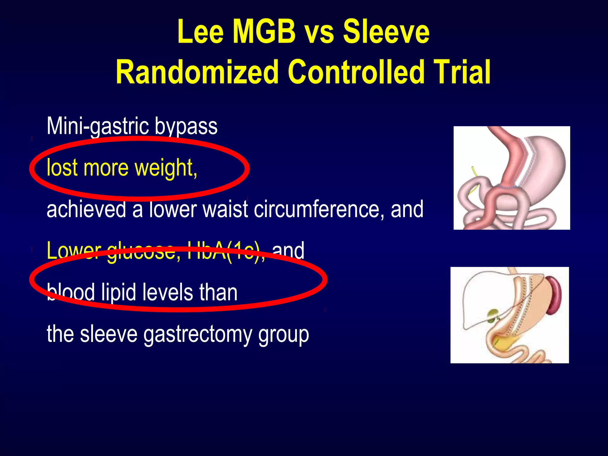 Lee MGB vs Sleeve
Randomized Controlled Trial
Mini-gastric bypass
lost more weight,
achieved a lower waist circumference, and
Lower glucose, HbA(1c), and
blood lipid levels than
the sleeve gastrectomy group
 