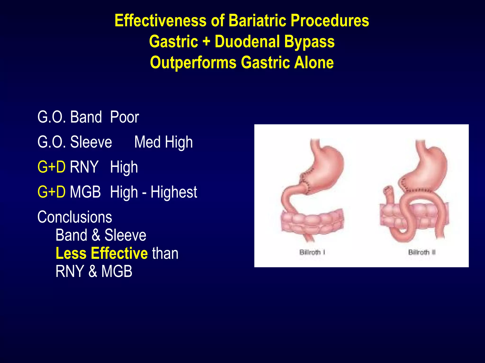 Effectiveness of Bariatric Procedures
Gastric + Duodenal Bypass
Outperforms Gastric Alone
G.O. Band Poor
G.O. Sleeve Med High
G+D RNY High
G+D MGB High - Highest
Conclusions
Band & Sleeve
Less Effective than
RNY & MGB
 
