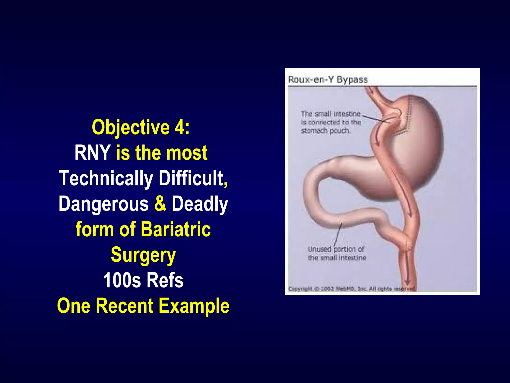 Objective 4:
RNY is the most
Technically Difficult,
Dangerous & Deadly
form of Bariatric
Surgery
100s Refs
One Recent Example
 