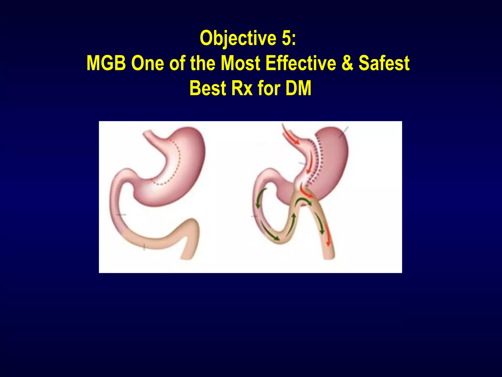 Objective 5:
MGB One of the Most Effective & Safest
Best Rx for DM
 