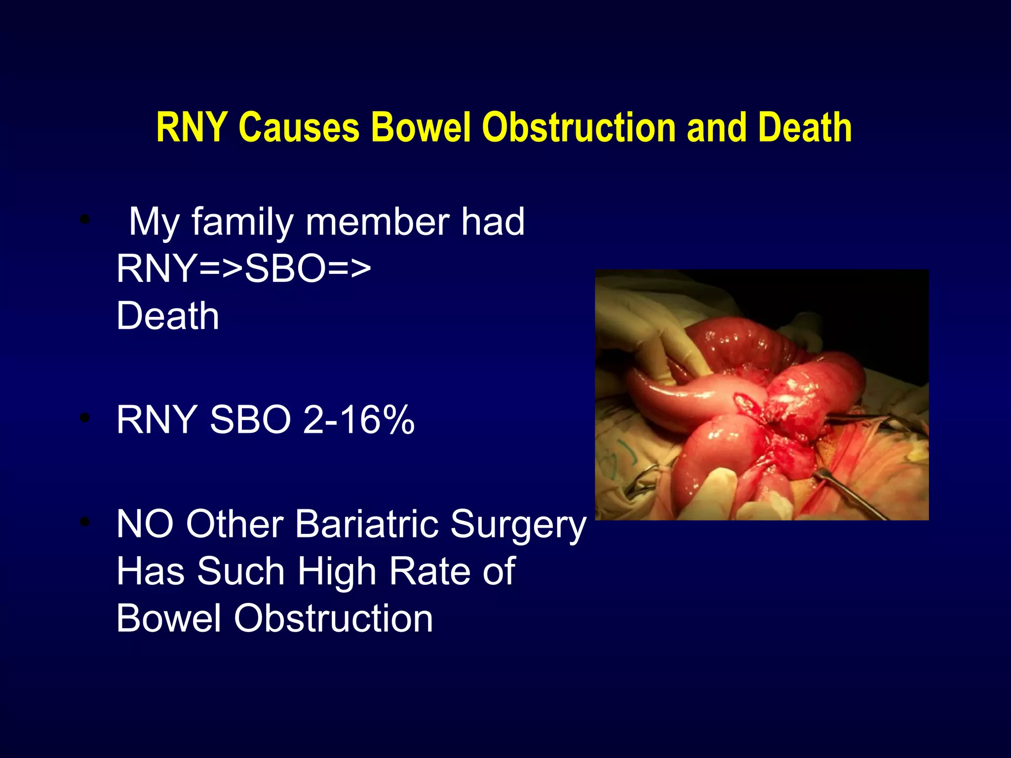 RNY Causes Bowel Obstruction and Death
• My family member had
RNY=>SBO=>
Death
• RNY SBO 2-16%
• NO Other Bariatric Surgery
Has Such High Rate of
Bowel Obstruction
 