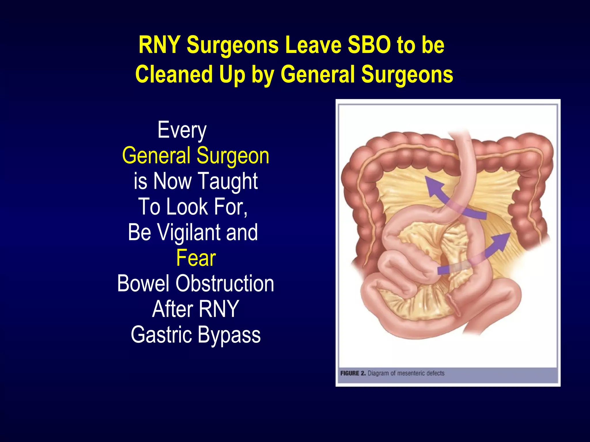 RNY Surgeons Leave SBO to be
Cleaned Up by General Surgeons
Every
General Surgeon
is Now Taught
To Look For,
Be Vigilant and
Fear
Bowel Obstruction
After RNY
Gastric Bypass
 