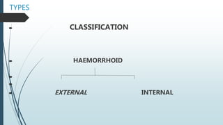 TYPES
 CLASSIFICATION
 HAEMORRHOID


 EXTERNAL INTERNAL
 