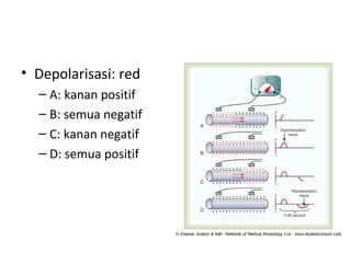 • Depolarisasi: red 
– A: kanan positif 
– B: semua negatif 
– C: kanan negatif 
– D: semua positif 
 