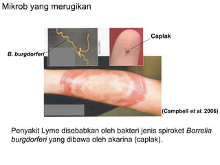 Mikrob yang merugikan


                                            Caplak

 B. burgdorferi




                                               (Campbell et al. 2006)


  Penyakit Lyme disebabkan oleh bakteri jenis spiroket Borrelia
  burgdorferi yang dibawa oleh akarina (caplak).
 