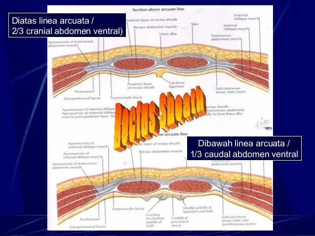 Спигелиевая линия анатомия. Linea arcuata перевод. Спигелиевая линия живота анатомия. Linea arcuata живота. Поперечная мышца живота анатомия.