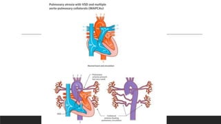 Fetal and Neonatal Circulation: Physiology, Transition, and Critical ...
